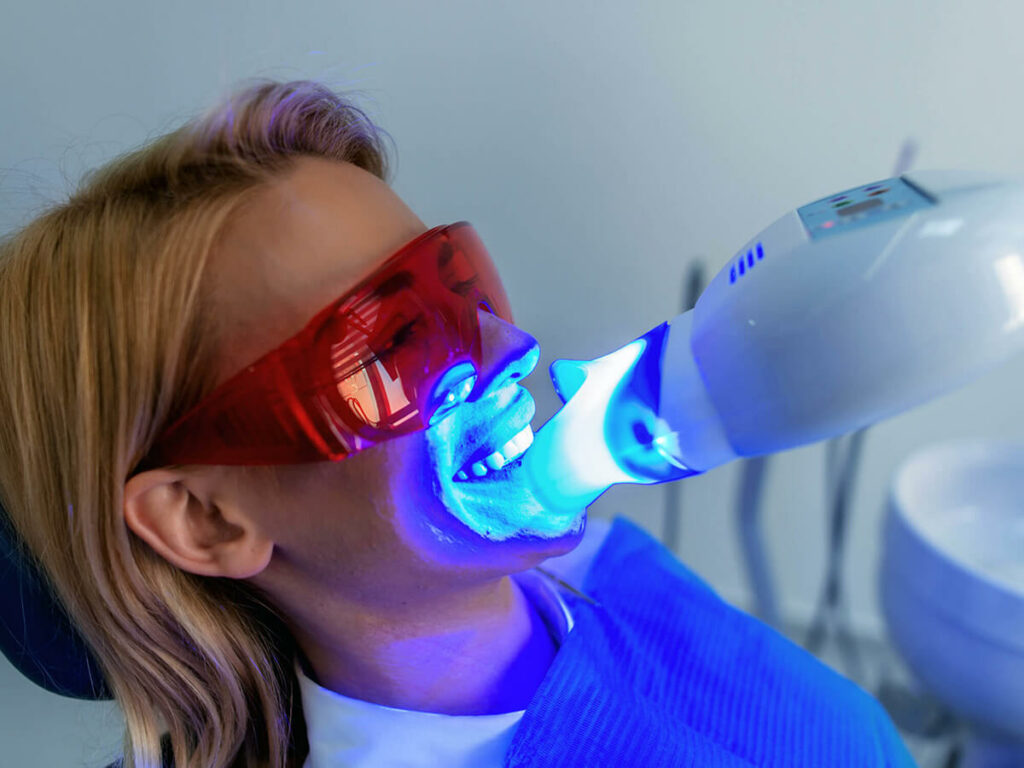 teeth whitening on patient